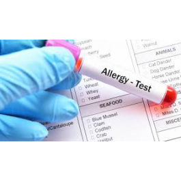 Test Estudio de 20 IgE- alergias alimentarias
