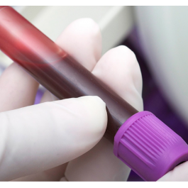 Test A200 Sangre - Intolerancia Alimentaria (Sangre)